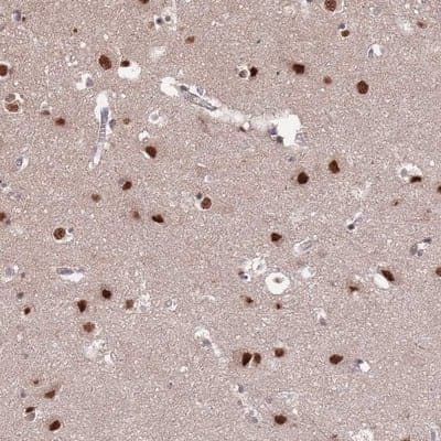 Immunohistochemistry-Paraffin: ST5 Antibody [NBP2-13391] - Staining of human cerebral cortex shows strong nuclear positivity in neuronal cells.