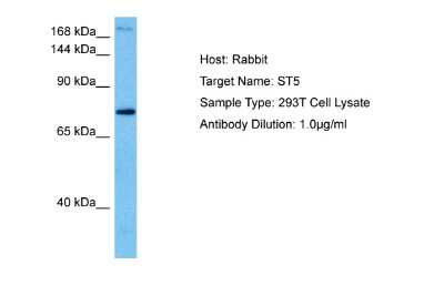 Western Blot: ST5 Antibody [NBP2-85833] - Host: Rabbit. Target Name: ST5. Sample Tissue: Human 293T Whole Cell lysates. Antibody Dilution: 1ug/ml
