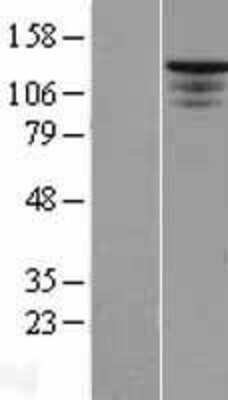 Western Blot: ST5 Overexpression Lysate (Adult Normal) [NBP2-07752] Left-Empty vector transfected control cell lysate (HEK293 cell lysate); Right -Over-expression Lysate for ST5.