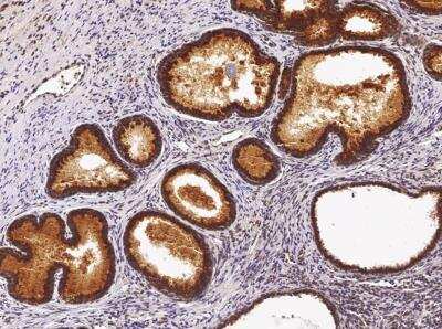 Immunohistochemistry-Paraffin: ST6 Gal Sialyltransferase 1/ST6GAL1/CD75 Antibody (036) [NBP2-89923] -  Staining of human ST6GAL1 in human prostate with rabbit monoclonal antibody (1:200).