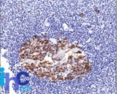 Immunohistochemistry-Paraffin: ST6 Gal Sialyltransferase 1/ST6GAL1/CD75 Antibody (LN-1) - Azide and BSA Free [NBP2-47890] - Formalin-fixed, paraffin-embedded normal human spleen stained with CDw75 monoclonal antibody (LN-1).