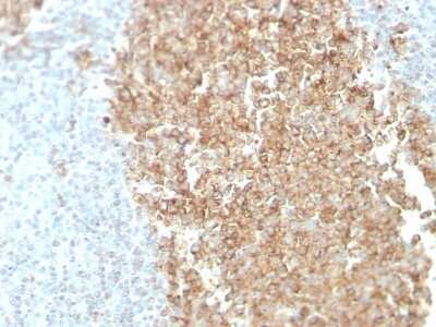 Immunohistochemistry-Paraffin: ST6 Gal Sialyltransferase 1/ST6GAL1/CD75 Antibody (ZB55) - Azide and BSA Free [NBP3-08436] - Formalin-fixed, paraffin-embedded normal human spleen tissue stained with ST6 Gal Sialyltransferase 1/ST6GAL1/CD75 Mouse Monoclonal Antibody (ZB55).