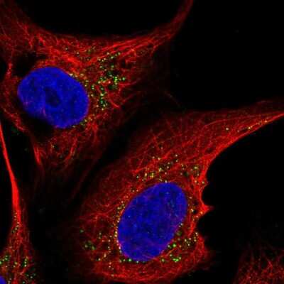 Immunocytochemistry/Immunofluorescence: ST6 GalNAc alpha-2,6-sialyltransferaseV/ST6GALNAC5 Antibody [NBP2-56572] - Staining of human cell line U-2 OS shows localization to vesicles.