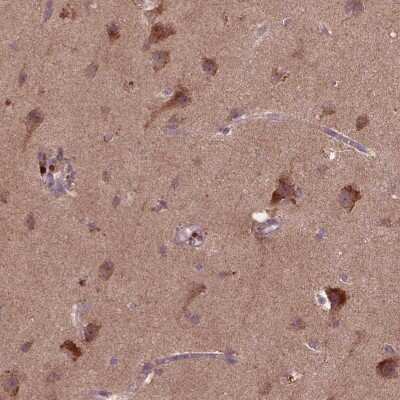 Immunohistochemistry: ST6 GalNAc alpha-2,6-sialyltransferaseV/ST6GALNAC5 Antibody [NBP2-49632] - Staining of human cerebral cortex shows strong positivity in neuronal cells.