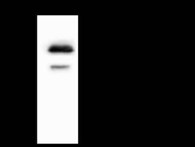 Immunoprecipitation: ST6 GalNAc alpha-2,6-sialyltransferaseV/ST6GALNAC5 Antibody [NBP2-98479] - ST6 GalNAc alpha-2,6-sialyltransferaseV/ST6GALNAC5 was immunoprecipitated using: Lane A: 0.5 mg U251MG Whole Cell Lysate 4 ul anti-ST6 GalNAc alpha-2,6-sialyltransferaseV/ST6GALNAC5 rabbit polyclonal antibody and 60 ug of Immunomagnetic beads Protein A/G.  Primary antibody: Anti-ST6 GalNAc alpha-2,6-sialyltransferaseV/ST6GALNAC5 rabbit polyclonal antibody, at 1:100 dilution. Secondary antibody: Goat Anti-Rabbit IgG (H+L)/HRP at 1/10000 dilution. Developed using the ECL technique. Performed under reducing conditions. Predicted band size: 38 kDa. Observed band size: 38 kDa