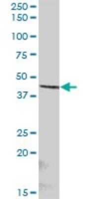 Western Blot: ST6 Sialyltransferase 2/ST6GALNAC2 Antibody [H00010610-B01P] - Analysis of ST6GALNAC2 expression in human spleen.