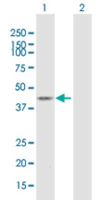 Western Blot: ST6 Sialyltransferase 2/ST6GALNAC2 Antibody [H00010610-B01P] - Analysis of ST6GALNAC2 expression in transfected 293T cell line by ST6GALNAC2 polyclonal antibody.  Lane 1: ST6GALNAC2 transfected lysate(41.14 KDa). Lane 2: Non-transfected lysate.