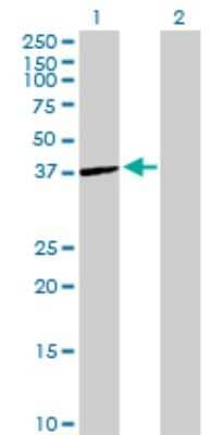 Western Blot: ST6 Sialyltransferase 6/ST6GALNAC6 Antibody [H00030815-B01P] - Analysis of ST6GALNAC6 expression in transfected 293T cell line by ST6GALNAC6 polyclonal antibody.  Lane 1: ST6GALNAC6 transfected lysate(36.74 KDa). Lane 2: Non-transfected lysate.