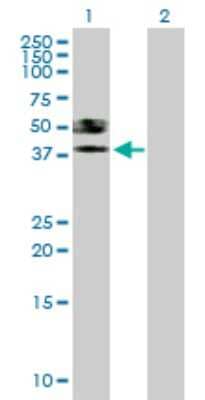 Western Blot: ST6 Sialyltransferase 6/ST6GALNAC6 Antibody [H00030815-B02P] - Analysis of ST6GALNAC6 expression in transfected 293T cell line by ST6GALNAC6 polyclonal antibody.  Lane 1: ST6GALNAC6 transfected lysate(36.63 KDa). Lane 2: Non-transfected lysate.