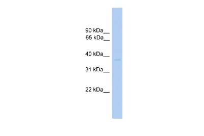 Western Blot: ST6 Sialyltransferase 6/ST6GALNAC6 Antibody [NBP3-09229] - Western blot analysis using NBP3-09229 on Human Heart as a positive control. Antibody Titration: 0.2-1 ug/ml