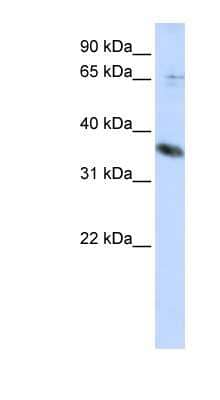 Western Blot: ST6GALNAC1 Antibody [NBP1-62649] - Titration: 0.2-1 ug/ml, Positive Control: HepG2 cell lysate.