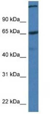 Western Blot: ST6GALNAC1 Antibody [NBP1-79210] - Mouse Pancreas Lysate 1ug/ml Gel Concentration 12%