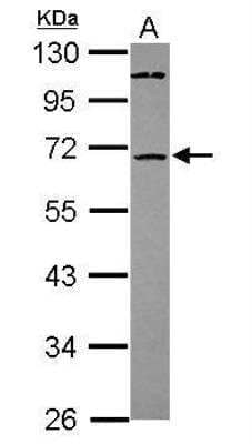 Western Blot: ST6GALNAC1 Antibody [NBP2-20493] - Sample (30 ug of whole cell lysate) A: HeLa 10% SDS PAGE  diluted at 1:1000 