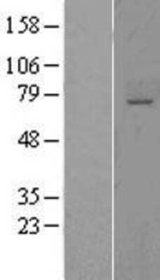 Western Blot: ST6GALNAC1 Overexpression Lysate (Adult Normal) [NBL1-16498] Left-Empty vector transfected control cell lysate (HEK293 cell lysate); Right -Over-expression Lysate for ST6GALNAC1.