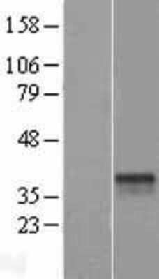 Western Blot: ST6GALNAC3 Overexpression Lysate (Adult Normal) [NBL1-16500] Left-Empty vector transfected control cell lysate (HEK293 cell lysate); Right -Over-expression Lysate for ST6GALNAC3.