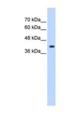 Western Blot: ST6GALNAC5 Antibody [NBP1-69618] - This Anti-ST6GALNAC5 antibody was used in Western Blot of Jurkat tissue lysate at a concentration of 1.25ug/ml.