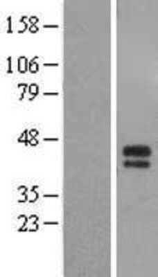 Western Blot ST6 GalNAc alpha-2,6-sialyltransferaseV/ST6GALNAC5 Overexpression Lysate