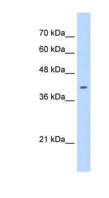 Western Blot: ST6GALNAC6 Antibody [NBP1-59959] - HepG2 cell lysate, concentration 0.2-1 ug/ml.