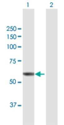 Western Blot: ST7/LRP12 Antibody [H00007982-B01P] - Analysis of ST7 expression in transfected 293T cell line by ST7 polyclonal antibody.  Lane 1: ST7 transfected lysate(60.17 KDa). Lane 2: Non-transfected lysate.