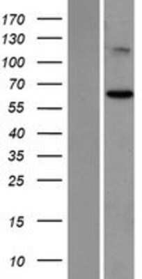 Western Blot Suppression of Tumorigenicity 7 Overexpression Lysate