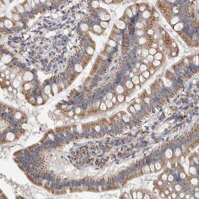 Immunohistochemistry-Paraffin: ST8 alpha-2,8-Sialyltransferase 8A/ST8SIA1/Ganglioside GD3 Antibody [NBP1-80750] - Staining of human small intestine shows moderate cytoplasmic positivity in glandular cells.