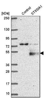 Western Blot: ST8 alpha-2,8-Sialyltransferase 8A/ST8SIA1/Ganglioside GD3 Antibody [NBP1-80750] - Analysis in control (vector only transfected HEK293T lysate) and sT8SIA1 over-expression lysate (Co-expressed with a C-terminal myc-DDK tag (3.1 kDa) in mammalian HEK293T cells).