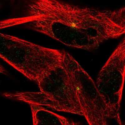 Immunocytochemistry/Immunofluorescence: ST8 alpha-2,8-Sialyltransferase 8B/ST8SIA2 Antibody [NBP2-33719] - Immunofluorescent staining of human cell line RH-30 shows localization to microtubule organizing center.