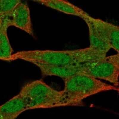 Immunocytochemistry/Immunofluorescence: ST8 alpha-2,8-Sialyltransferase 8B/ST8SIA2 Antibody [NBP3-17939] - Staining of human cell line SH-SY5Y shows localization to nucleoplasm, cytosol & the Golgi apparatus.