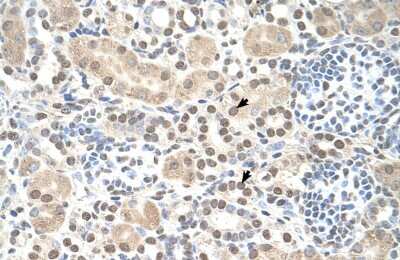 Immunohistochemistry: ST8 alpha-2,8-Sialyltransferase 8B/ST8SIA2 Antibody [NBP1-69280] - Staining of human kidney.