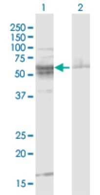 Western Blot: ST8 alpha-2,8-Sialyltransferase 8B/ST8SIA2 Antibody [H00008128-D01P] - Analysis of ST8SIA2 expression in transfected 293T cell line by ST8SIA2 polyclonal antibody.Lane 1: ST8SIA2 transfected lysate(40.20 KDa).Lane 2: Non-transfected lysate.