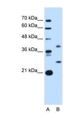 Western Blot: ST8 alpha-2,8-Sialyltransferase 8B/ST8SIA2 Antibody [NBP1-69280] - This Anti-ST8SIA2 antibody was used in Western Blot of HepG2 tissue lysate at a concentration of 1ug/ml.