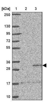 Western Blot: ST8 alpha-2,8-Sialyltransferase 8B/ST8SIA2 Antibody [NBP2-33719] - Lane 1: Marker  [kDa] 250, 130, 95, 72, 55, 36, 28, 17, 10.  Lane 2: Human cell line RT-4.  Lane 3: Human cell line U-251MG sp