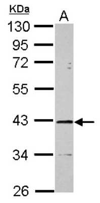 Western Blot: ST8SIA2 Antibody [NBP2-15129] - Sample (30 ug of whole cell lysate) A: HL-60 10% SDS PAGE, antibody diluted at 1:2000.