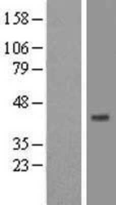 Western Blot: ST8SIA2 Overexpression Lysate (Adult Normal) [NBP2-07682] Left-Empty vector transfected control cell lysate (HEK293 cell lysate); Right -Over-expression Lysate for ST8SIA2.