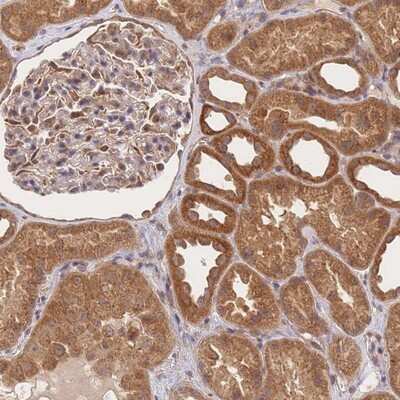 Immunohistochemistry-Paraffin: ST8SIA4 Antibody [NBP2-13393] - Staining of human kidney shows strong cytoplasmic positivity in cells in tubules.