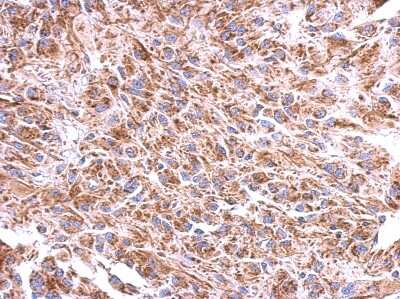 Immunohistochemistry-Paraffin: ST8SIA4 Antibody [NBP2-20497] - Immunohistochemical analysis of paraffin-embedded U373 xenograft, using antibody at 1:500 dilution.