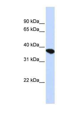 Western Blot: ST8SIA4 Antibody [NBP1-79292] - HepG2 cell lysate, concentration 0.2-1 ug/ml.