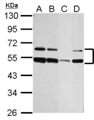 Western Blot: ST8SIA4 Antibody [NBP2-20497] - Sample (30 ug of whole cell lysate) A: Jurkat B: Raji C: THP-1 D: NCI-H929 10% SDS PAGE gel, diluted at 1:1000.