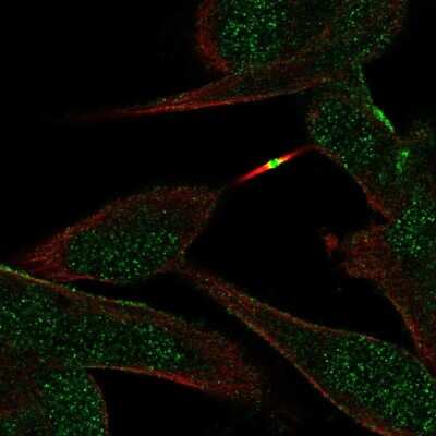 Immunocytochemistry/Immunofluorescence: ST8SIA5 Antibody [NBP2-30530] - Staining of human cell line RH-30 shows localization to plasma membrane & midbody. Antibody staining is shown in green.