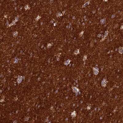 Immunohistochemistry-Paraffin: ST8SIA5 Antibody [NBP2-30493] - Staining of human cerebral cortex shows strong positivity in neuropil.