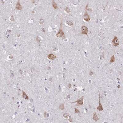 Immunohistochemistry-Paraffin: ST8SIA5 Antibody [NBP2-30530] - Staining of human cerebral cortex shows moderate cytoplasmic positivity in neurons.