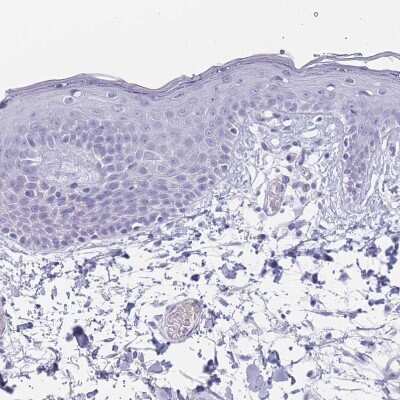 Immunohistochemistry-Paraffin: ST8SIA5 Antibody [NBP2-30530] - Staining of human skin shows no positivity in squamous epithelial cells as expected.