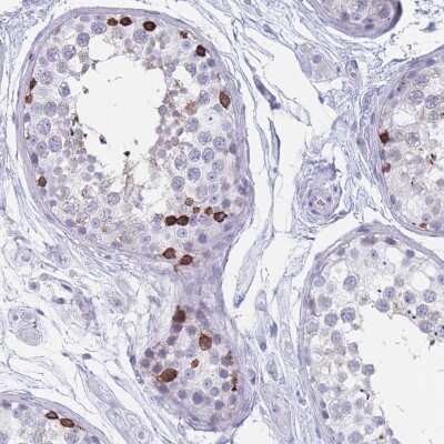 Immunohistochemistry-Paraffin: ST8SIA5 Antibody [NBP2-30530] - Staining of human testis shows strong cytoplasmic positivity in cells in seminiferous ducts.