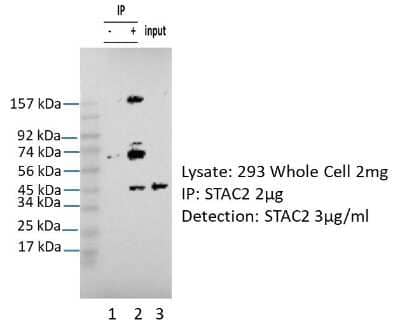 Western Blot: STAC2 Antibody [NBP3-09669] - STAC2 was immunoprecipitated from 1 mg HEK293 Whole Cell Lysate with NBP3-09669 with 1:200 dilution. Western blot was performed using NBP3-09669 at 1/1000 dilution. Lane 1: Control IP in HEK293 Whole Cell Lysate. Lane 2: STAC2 IP with NBP3-09669 in HEK293