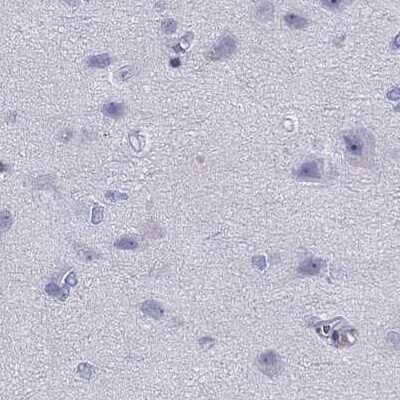 Immunohistochemistry-Paraffin: STAG3 Antibody [NBP2-38851] - Staining of human cerebral cortex.