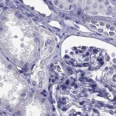 Immunohistochemistry-Paraffin: STAG3 Antibody [NBP2-38851] - Staining of human kidney.