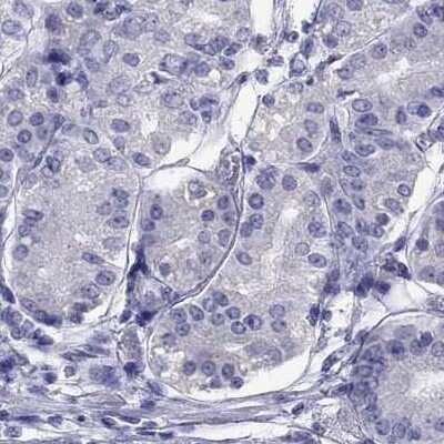 Immunohistochemistry-Paraffin: STAG3 Antibody [NBP2-38851] - Staining of human stomach using Anti-STAG3 antibody NBP2-38851.