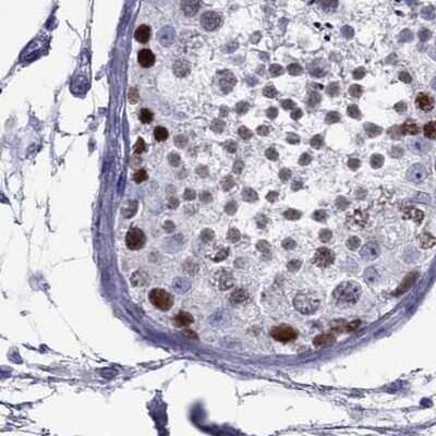 Immunohistochemistry-Paraffin: STAG3 Antibody [NBP2-38851] - Staining of human testis using Anti-STAG3 antibody NBP2-38851.