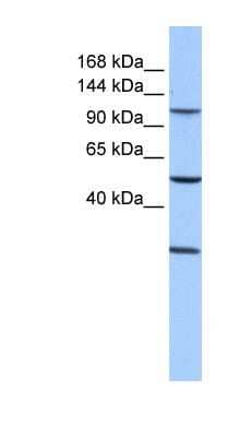 Western Blot: STAG3 Antibody [NBP1-58087] - 721_B cell lysate, concentration 0.2-1 ug/ml.