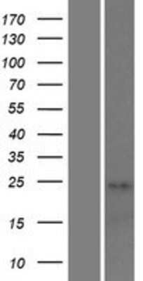 Western Blot: STAG3L1 Overexpression Lysate (Adult Normal) [NBP2-06743] Left-Empty vector transfected control cell lysate (HEK293 cell lysate); Right -Over-expression Lysate for STAG3L1.